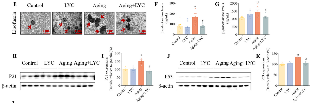  从线虫到人类：番茄红素的延寿机制深度解析 健康养生